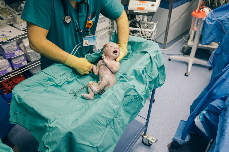 Caesarean Section